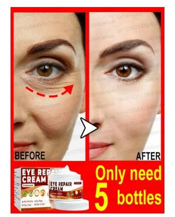 Eye Repair Cream (Pack of 2) 1pas00-1a